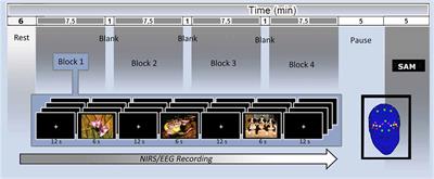 Emotion Regulation in Schizophrenia: A Pilot Clinical Intervention as Assessed by EEG and Optical Imaging (Functional Near-Infrared Spectroscopy)